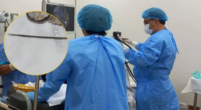 Interno de penal de máxima seguridad sobrevive tras tragarse una aguja de coser