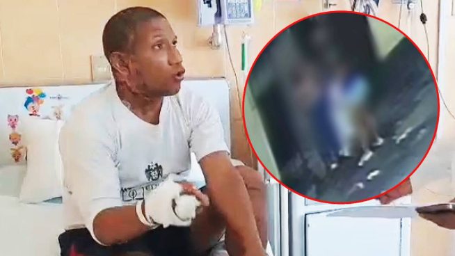 PJ dicta 9 meses de prisión preventiva para sujeto que prendió fuego a su pareja