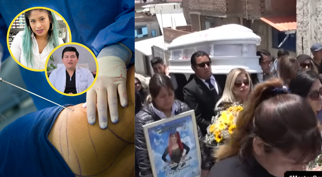 Muerte de empresaria durante lipoescultura: cirujano que la operó podría ser suspendido | VIDEO