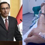 Martín Vizcarra afirma haber perdido un riñón tras operación: esto dijo el expresidente