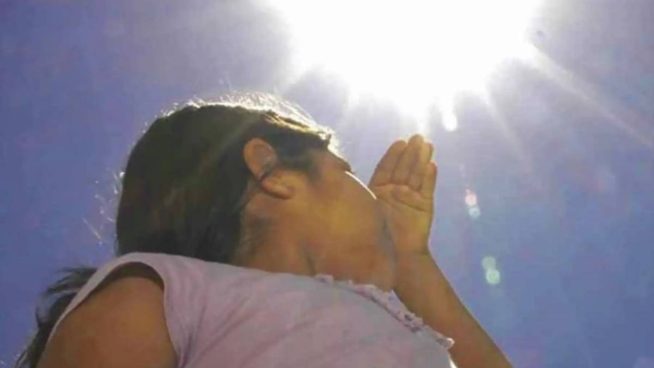 Prevención durante el verano: Mira cómo evitar quemaduras en niños y adolescentes