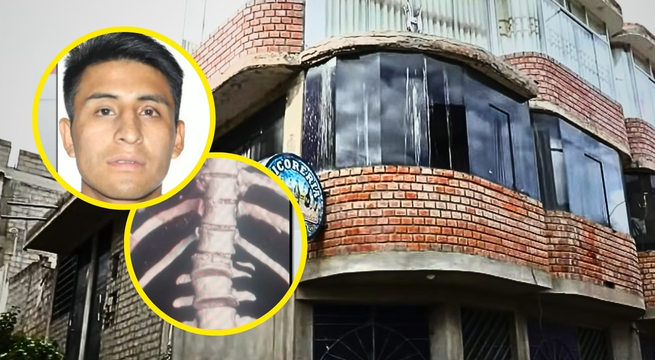 Falso chamán arroja a su pareja desde tercer piso y le roba 15 mil soles