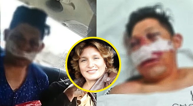 Puente Piedra: músico queda grave tras agresión de hijo de Abencia Meza