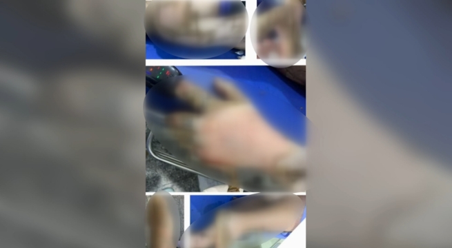 Declaran muerto a hombre tras paro cardiaco y despierta en la morgue