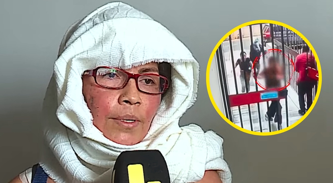 Mujer baleada en condominio sospecha que su esposo mandó a matarla: 