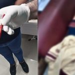 Niño de nueve años es operado tras sufrir broma pesada en el colegio