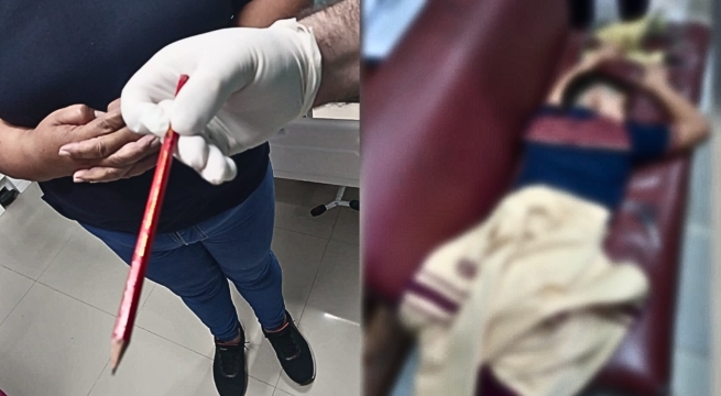 Niño de nueve años es operado tras sufrir broma pesada en el colegio