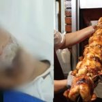 Le queman la boca por no pagar pollo a la brasa: víctima tiene 17 años