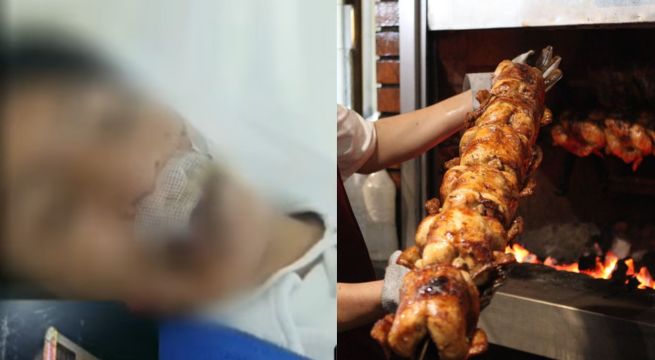 Le queman la boca por no pagar pollo a la brasa: víctima tiene 17 años