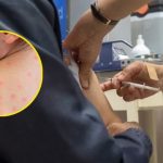 Amplían por 90 días la emergencia sanitaria por Sarampión mientras persiste rechazo a vacunación