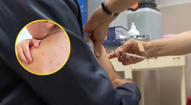 Amplían por 90 días la emergencia sanitaria por Sarampión mientras persiste rechazo a vacunación
