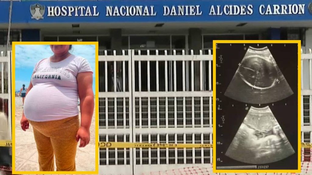 SUSALUD emitió nuevo comunicado sobre presunta desaparición de bebé gemelar en el Hospital Carrión