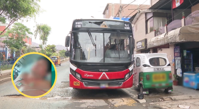 Conductor de empresa Lipetsa podría quedarse sin volver a caminar tras ataque a balazos | VIDEO