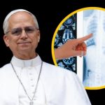 Papa León XIV anuncia que será operado por un nódulo pulmonar