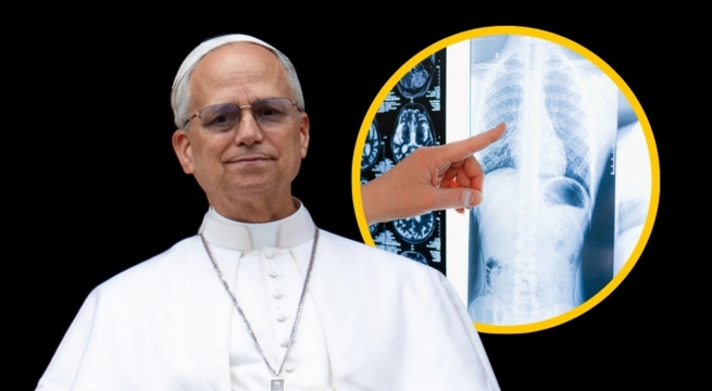 Papa León XIV anuncia que será operado por un nódulo pulmonar