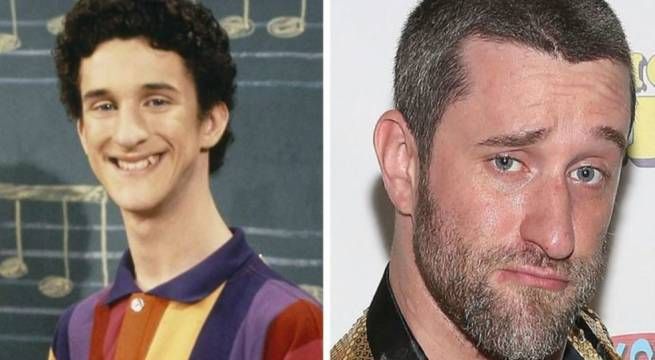 Muere el actor Dustin Diamond, el popular Screech de ‘Salvado por la Campana’