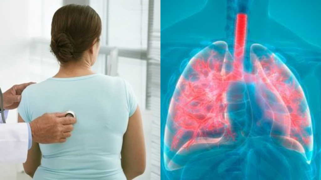 Más de 13 mil casos de neumonía en el país