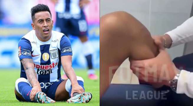 Christian Cueva: se difunde video revelador del estado actual de su rodilla lesionada