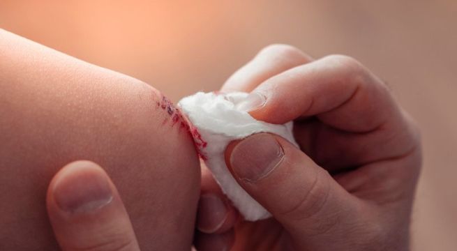 Por qué nunca deberías limpiar una herida con alcohol