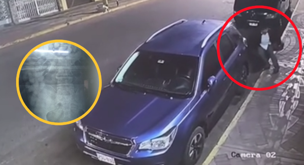 Hombre salva de morir luego que ovoide de cocaína reventara en su estómago