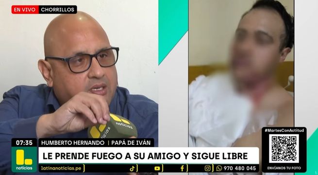 Jesús María: joven se niega a seguir tomando alcohol y su amigo lo quema vivo