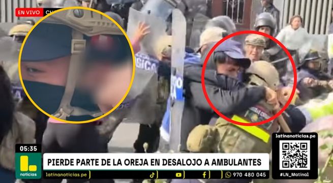 Vendedor ambulante mordió a sereno y le arrancó parte de la oreja | VIDEO